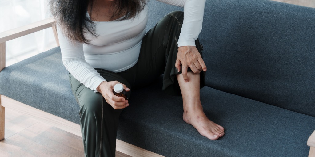 woman scratching her dermatitis feet while sitting on sofa