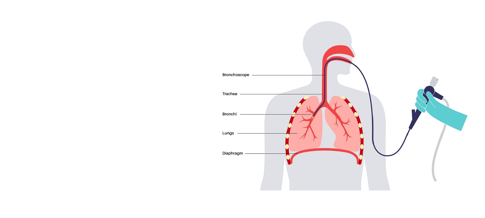 Pulmonary Endoscopy diagram